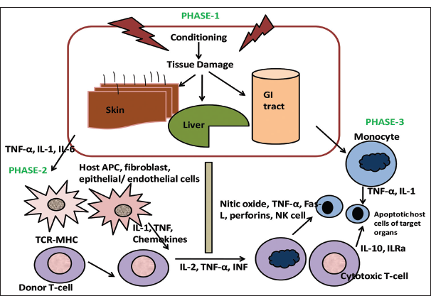 Schematic representation of pathophysiology of graft-versus-host disease. TNF: Tumor Necrosis Factor-α, TCR: T-cell receptor, IL: Interleukin, NK: Natural Killer, ILRα: Interleukin-1 receptor family members, Fas-L: Fas Ligand