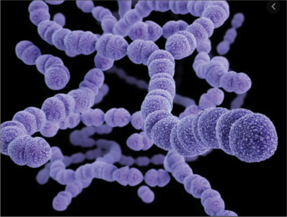 Streptococcus pneumoniae (Source: van der Poll and Opal, 2009).[58]