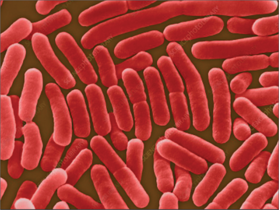 Salmonella typhi (Source: Nakamura et al., 1999).[34]